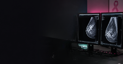 Dual monitors displaying mammography images in a breast imaging reading room.